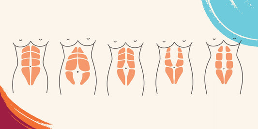 Core Question: What is Diastasis Recti? - Levelle, Inc